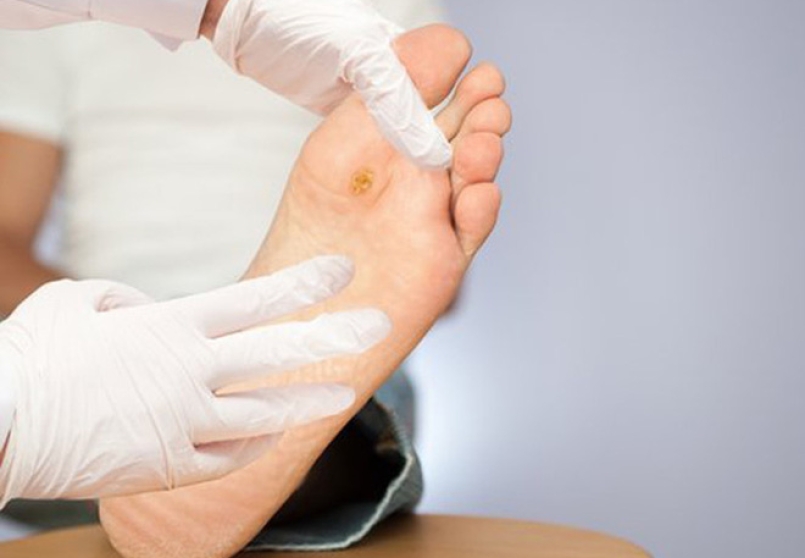 4 dấu hiệu bất thường ở chân nên “dừng lại” để kiểm tra sức khỏe